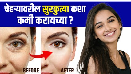 सुरकुत्या कमी कशा करायचे | How To Get Rid Of Face Wrinkles Quickly | Wrinkles Removal Home Remedy - Marathi News | | Latest sakhi News at Lokmat.com