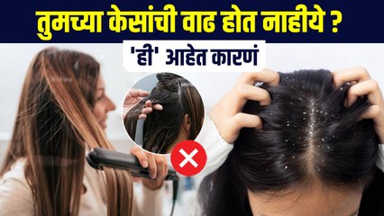 तुमच्या केसांची वाढ न होण्याचं 'हे' आहे कारण | Fast Hair Growth Tips In Marathi |Hair Care Tips MA2 - Marathi News | | Latest sakhi News at Lokmat.com