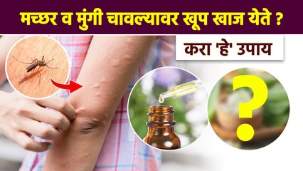 मच्छर व मुंगी चावल्यावर हे घरगुती उपाय नक्की करा Mosquitoes Bite |Mosquitoes Bite Home Remedies |AI2 - Marathi News | | Latest sakhi News at Lokmat.com