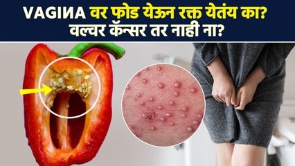 Vagina मधून रक्त येणं, फोड येणं सामान्य आहे का ? | Vulvar Cancer Symptoms | Womens Health | RI3 - Marathi News | | Latest sakhi News at Lokmat.com