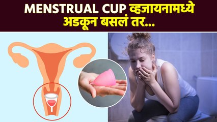 Menstrual Cup आतमध्येच राहिल असं वाटतंय ? | Menstrual Cup Stuck Inside Vagina | Womens Health RI2 - Marathi News | | Latest sakhi News at Lokmat.com