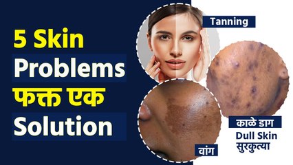 काळे डाग, वांग, tanning, सुरकुत्या, Dry Skin सगळ्या Problems वर एक Solution | Face Pack For Skin MA2 - Marathi News | | Latest sakhi News at Lokmat.com