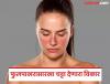 हा ब्लश नाही, महिलांना होणारा गंभीर आजार आहे; लुपस विकार ज्याने गर्भपातही होऊ शकतो