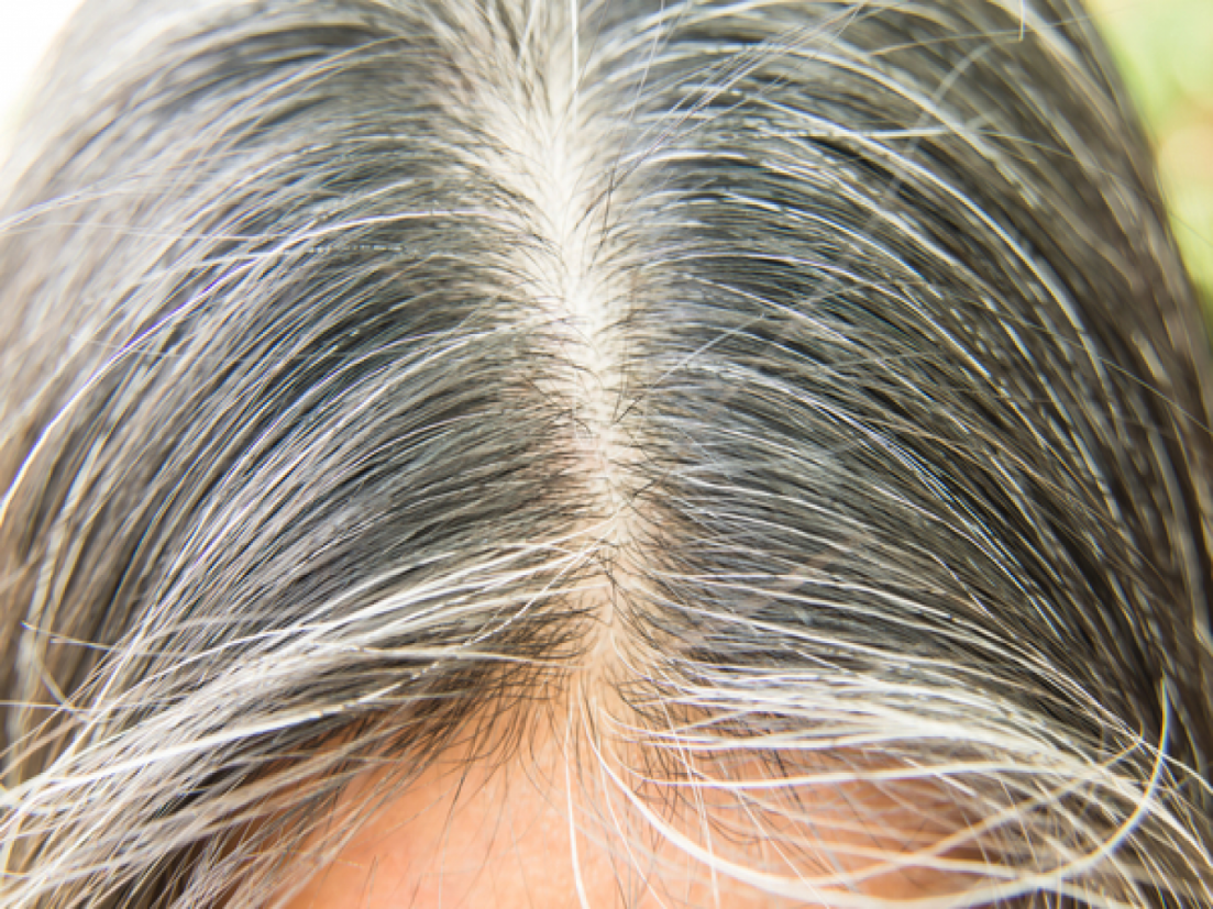 तरुण वयात केस पांढरे होतायत? घाबरु नका, 'या' नैसर्गिक उपायांनी राहतील केस  कायमचे काळे - Marathi News | how to color white or grey hair naturally at  home, remedies to stop white