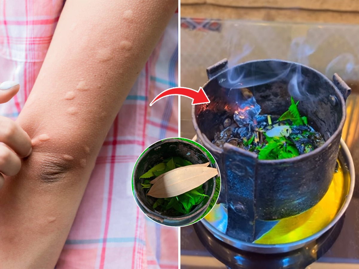 उन्हाळ्यात डास खूप चावतात, रात्रीची झोप उडाली? घरच्याघरी करा १ सोपा