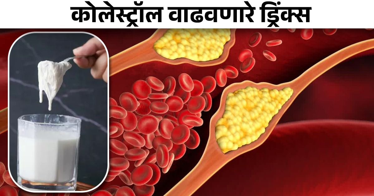 रक्तनलिकांमध्ये बॅड कोलेस्ट्रॉल जमा करतात 'हे' 5 ड्रिंक्स, वेळीच व्हा सावध! Marathi News