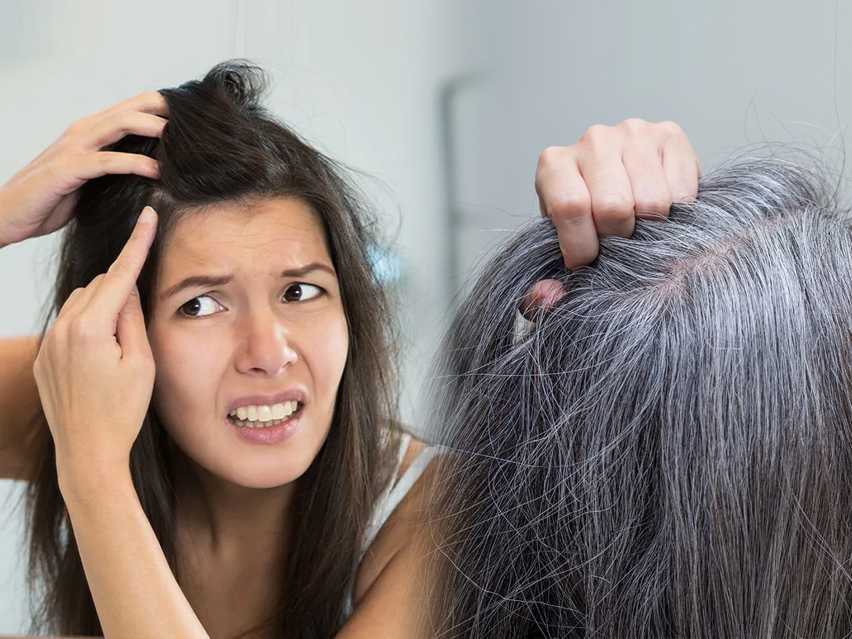 पांढरे झालेले केस पुन्हा काळे करायचे तर करा ४ गोष्टी, आयुर्वेदतज्ज्ञ  सांगतात... - Marathi News | How to Reverse Greying of Hair Naturally 4 Best  Home Remedies : Do 4 things to