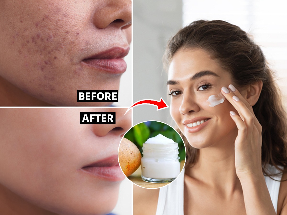 विकतच्या महागड्या क्रिम्स कशाला? रात्री झोपताना लावा होम मेड क्रिम