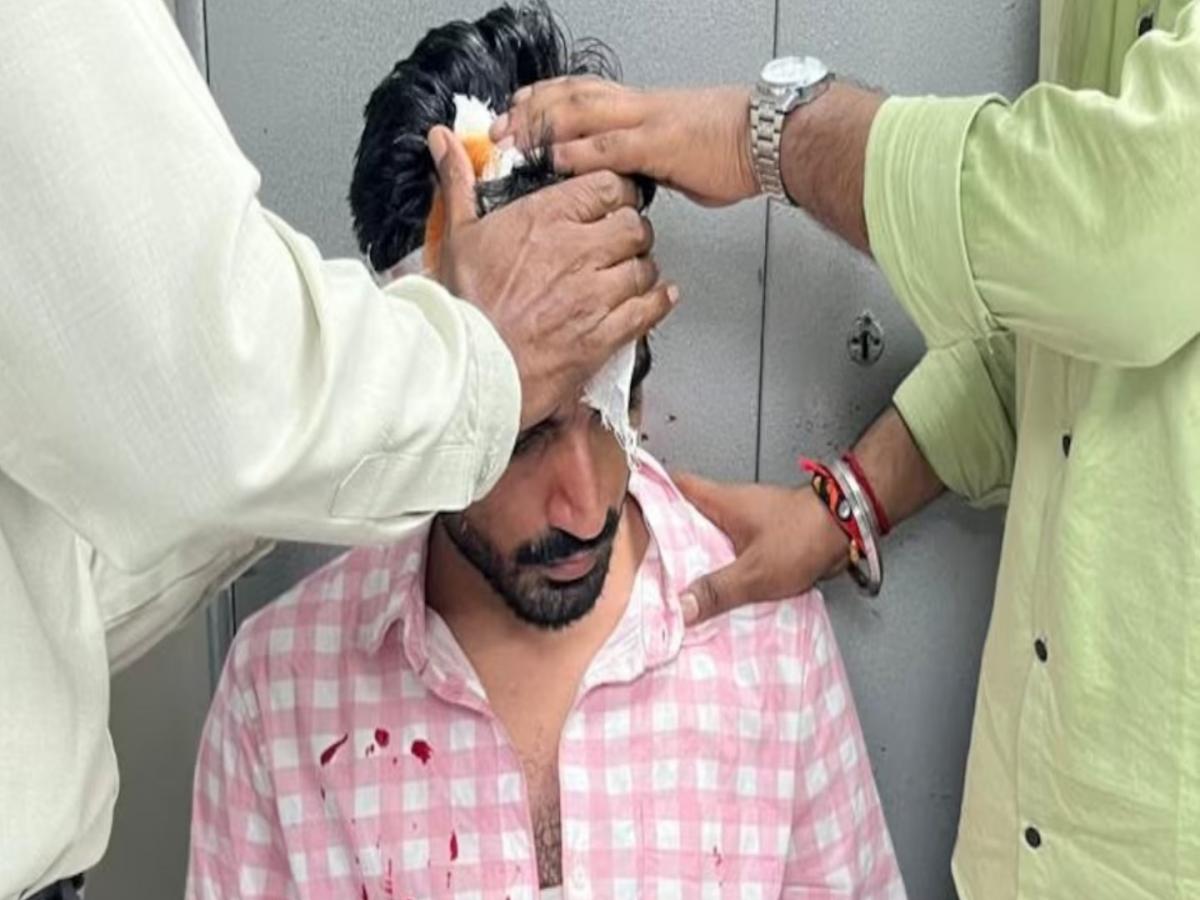 दिल्ली विद्यापीठात निवडणुकीपूर्वी तुफान हाणामारी; कॅम्पसमध्ये दोन गट भिडले; एक विद्यार्थी गंभीर
