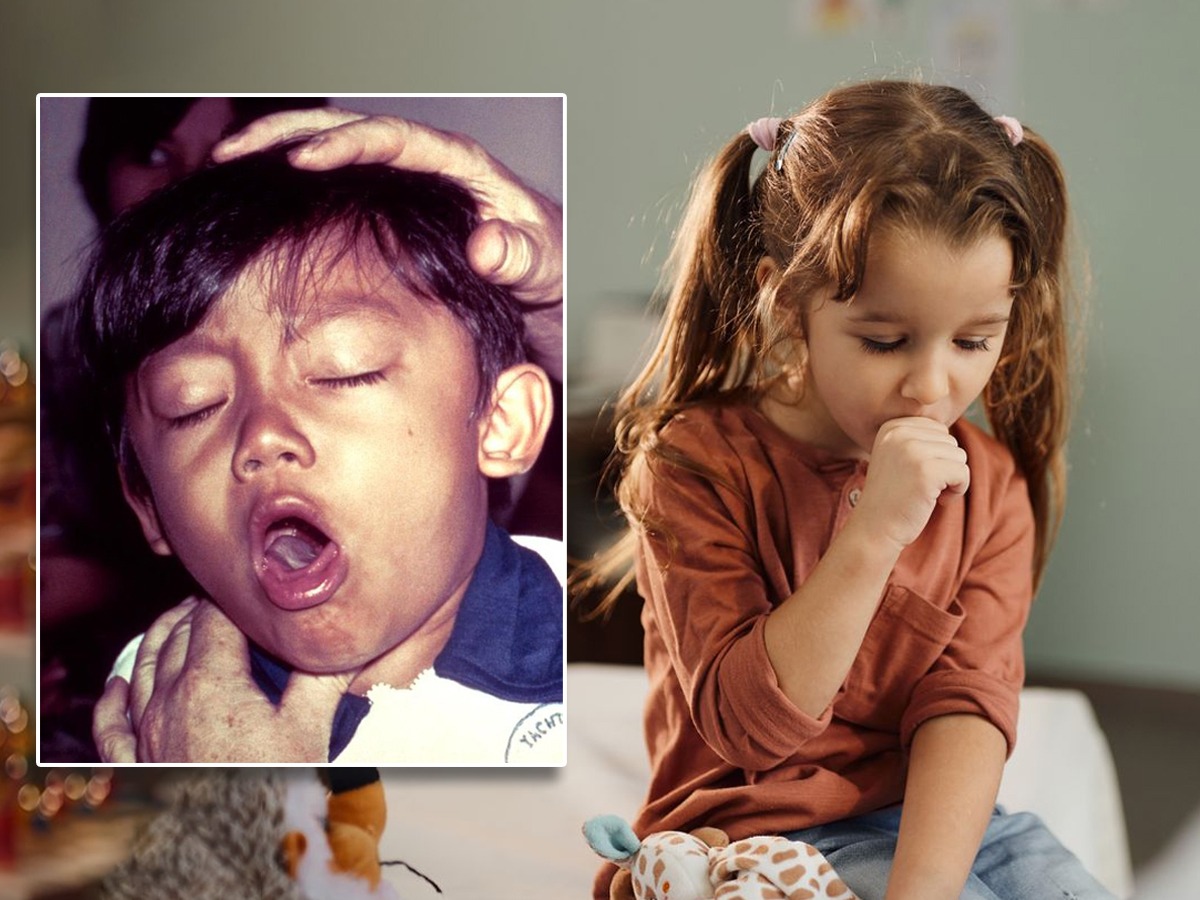 कोरड्या खोकल्याने मुलं हैराण, रात्रभर झोप नाही? तज्ज्ञ सांगतात १ सोपा