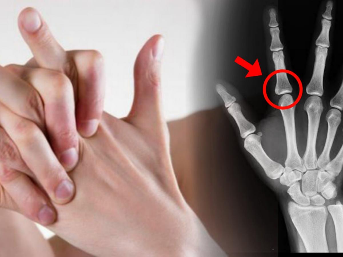 सारखी बोटं मोडता, सवय सुटता सुटत नाही? मग बोटं मोडण्याची सवय तोडा, ४