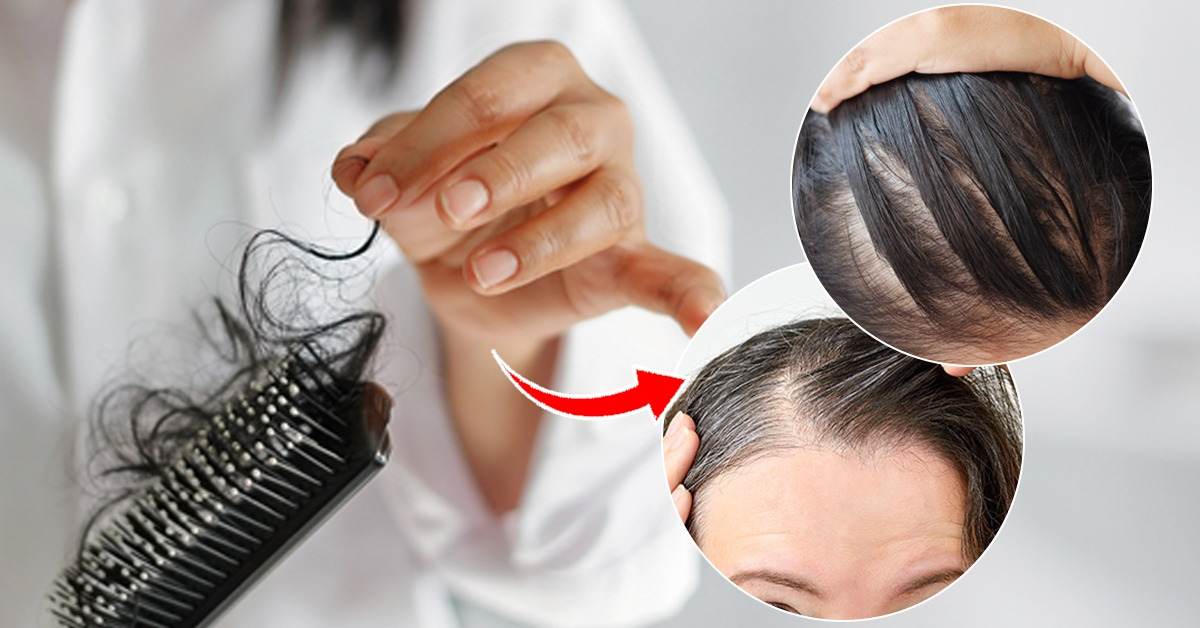 हिवाळ्यात केस अधिक का गळतात? हेअर फॉल थांबवण्यासाठी करा हे उपाय