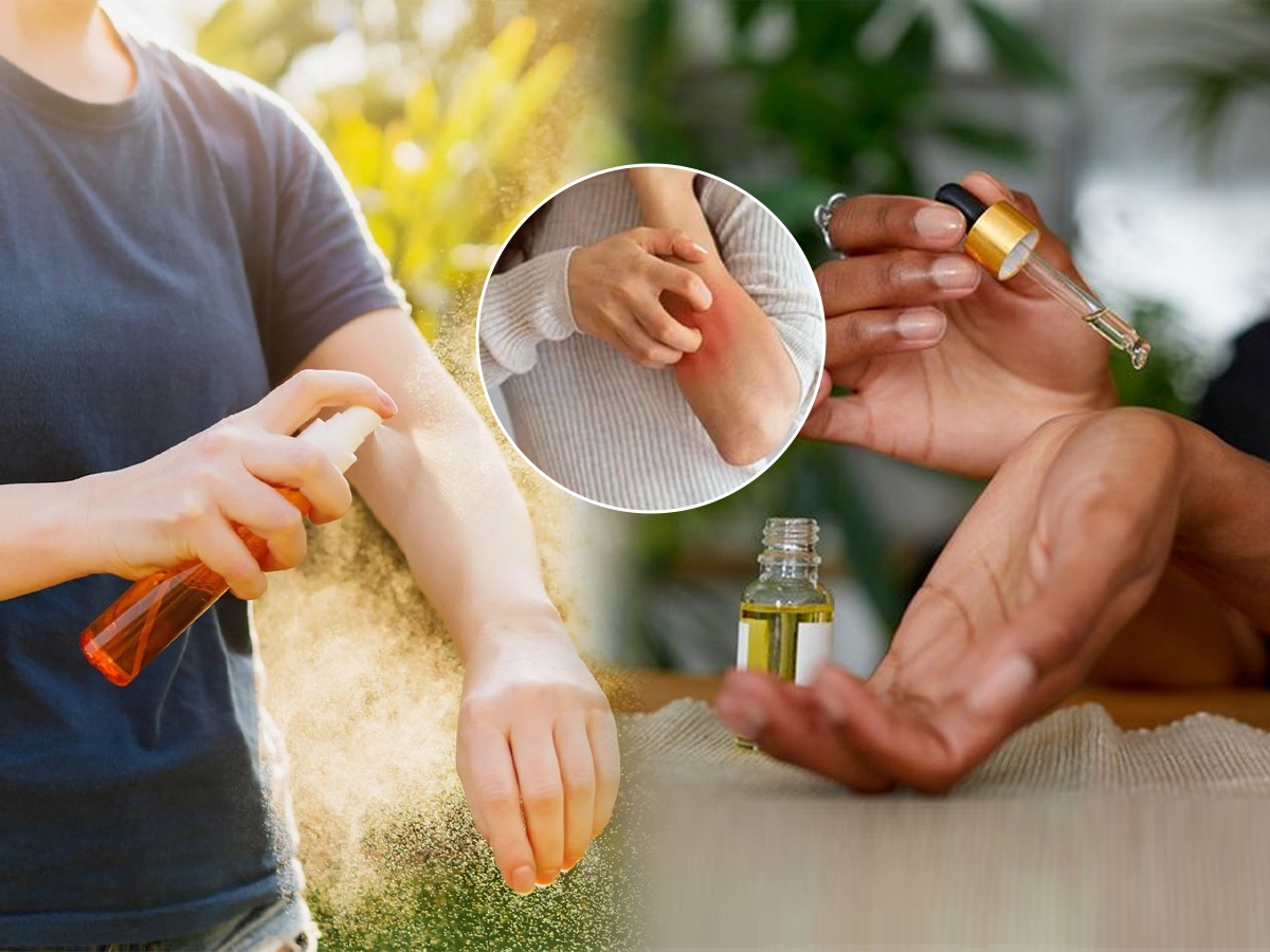 डास चावू नयेत म्हणून माॅस्किटो रिपेलंट क्रीम चोपडता? त्वचेवर होतात