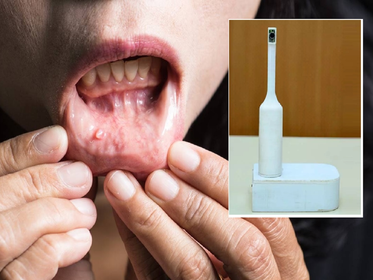 Oral cancer चे निदान टूथब्रशद्वारे लागणार, IIT Kanpur मध्ये बनवलेले ...