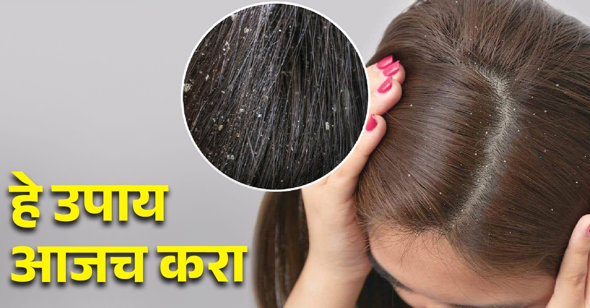 वारंवार डोके खाजवताय; हे कारण तर नाही ना Marathi News itchy scalp causes treatment and