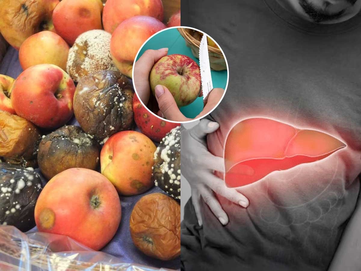 फळ सडलं तर तेवढा भाग कापून बाकीचं फळ खाता? ही काटकसर जीवावर बेतते कारण ...