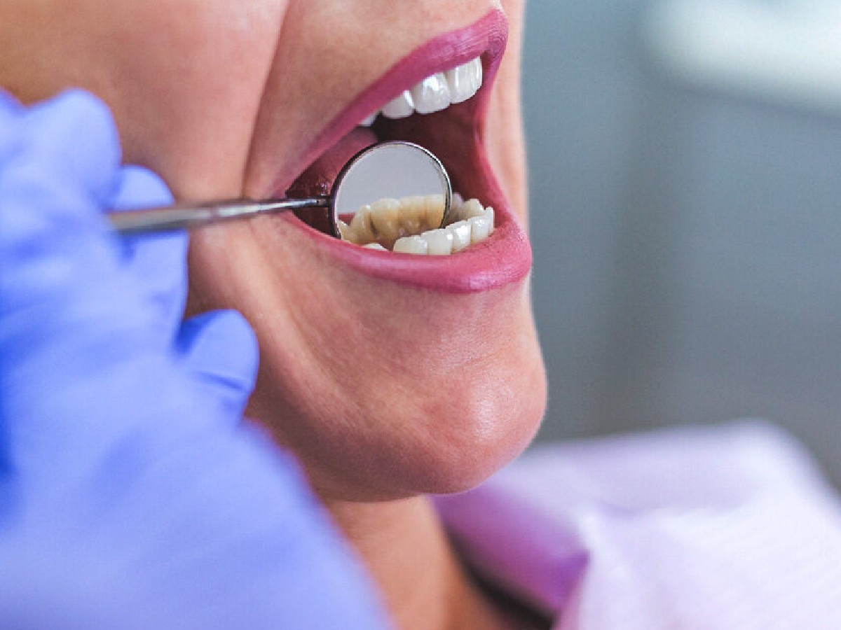 वजन कमी होत नाही म्हणून दातच शिवले, महिलेचे अजब कारनामा Marathi News