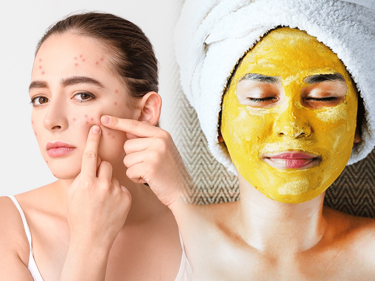 Mistakes To Avoid While Using Turmeric On Face चेहऱ्याला हळद लावताना चुकूनही करू नका या गोष्टी 5281