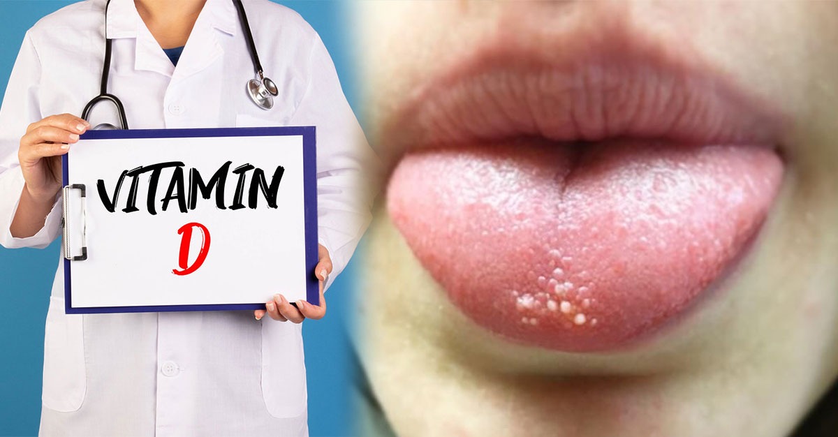 तुमची जीभ बघा, ती सांगते 'व्हिटॅमिन डी'ची कमतरता! लक्षणं कोणती, उपाय