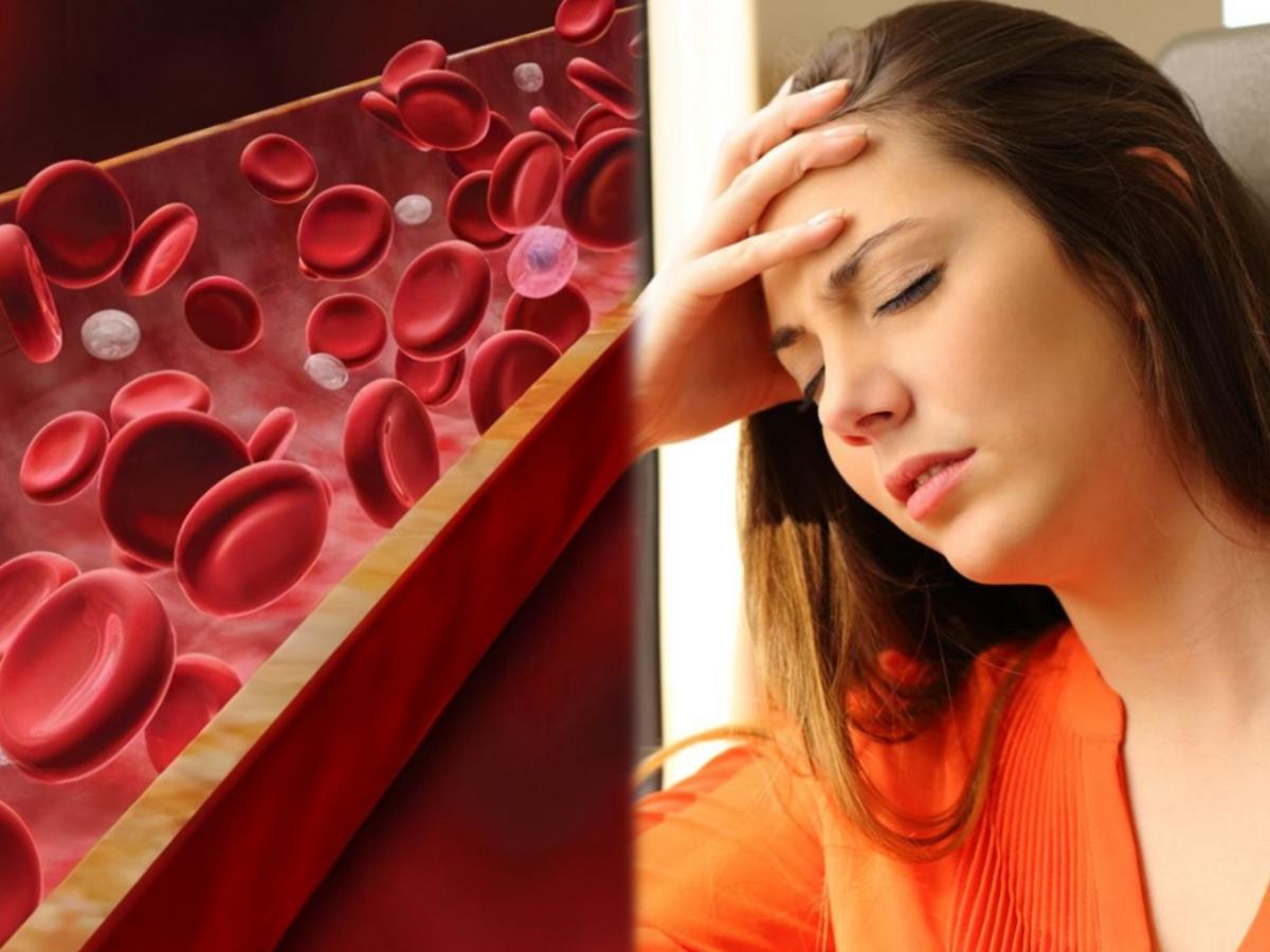 anaemia