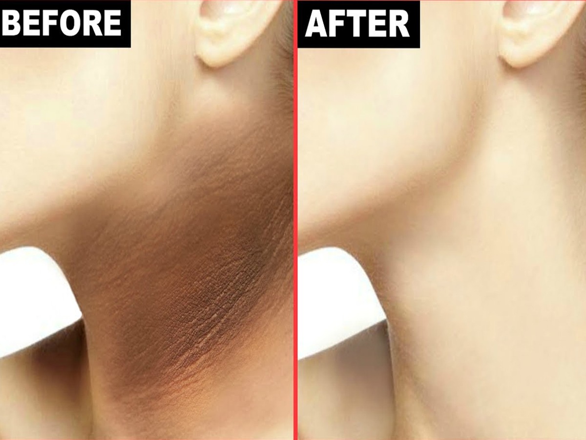 how-to-remove-tan-from-neck