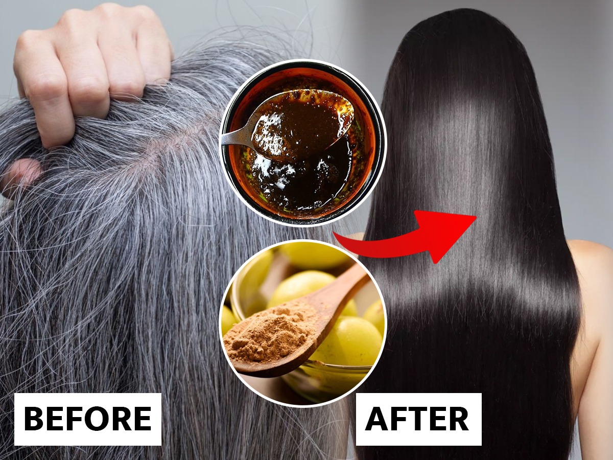 Home Remedies For White Hair : ऐन तारुण्यात केस पांढरे? स्वयंपाकघरातील ३  गोष्टी -३ उपाय, केस होतील दाट-काळेभोर - Marathi News | Home Remedies For White  Hair : White hair treatment onion
