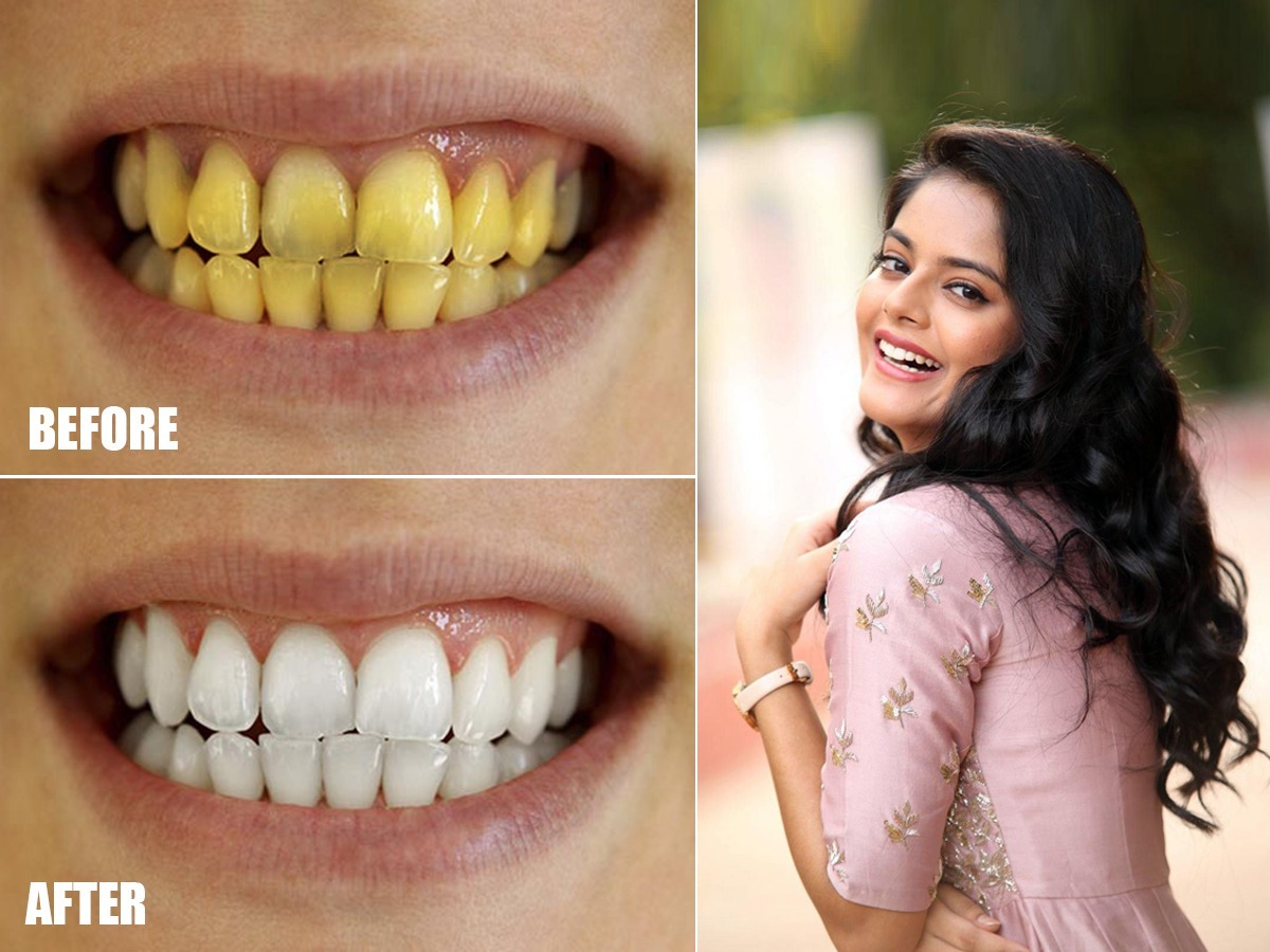 रोज स्वच्छ घासूनही दात पिवळट, खराब दिसतात? ५ उपाय, दात दिसतील