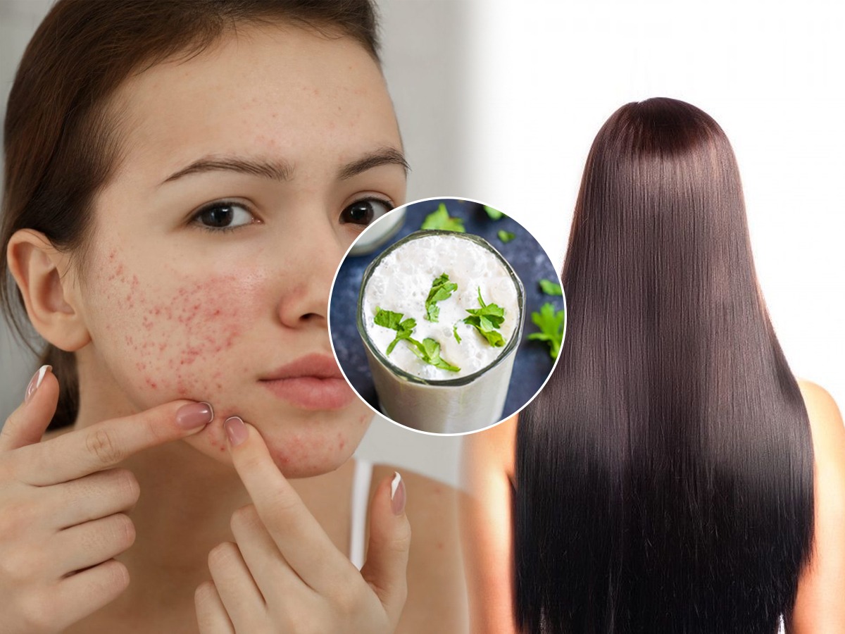 केस वाढतच नाहीत, चेहराही खूप खराब झाला? हा घ्या दोन्ही समस्यांवरचा १
