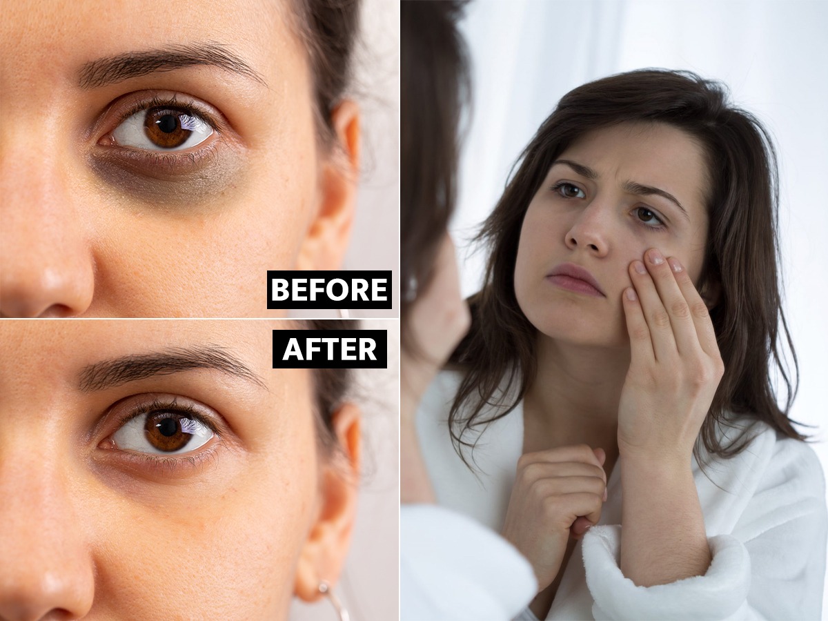 Mudra For Dark Circles mudra-for-dark-circles