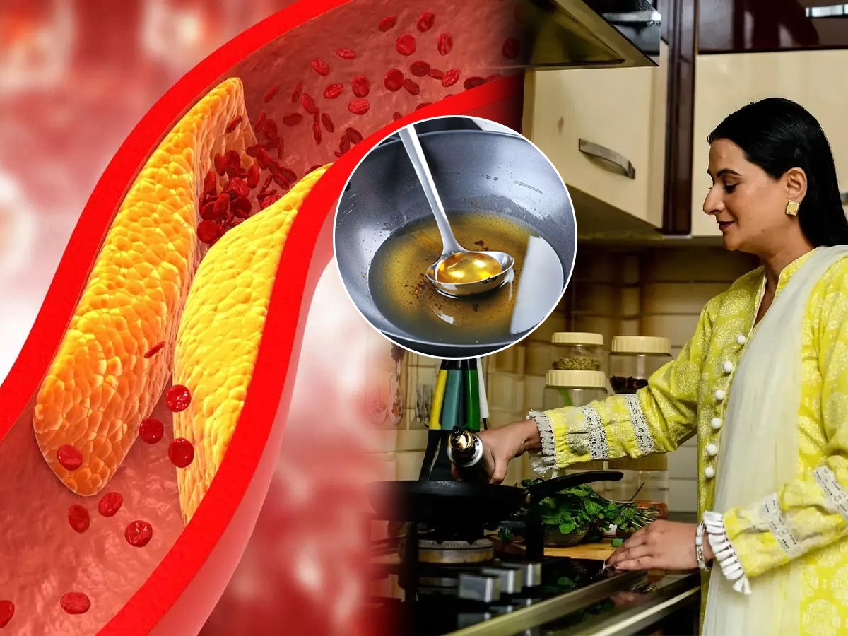 Flaxseed oil for high cholesterol बॅड कोलेस्टेरॉल वाढणारच नाही; फक्त