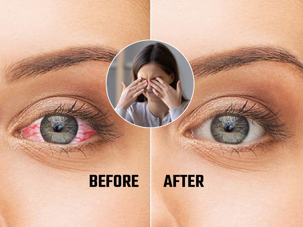 सतत स्क्रिन पाहून डोळ्यांवर ताण येतो, ड्रायनेस जाणवतो? १ सोपा उपाय