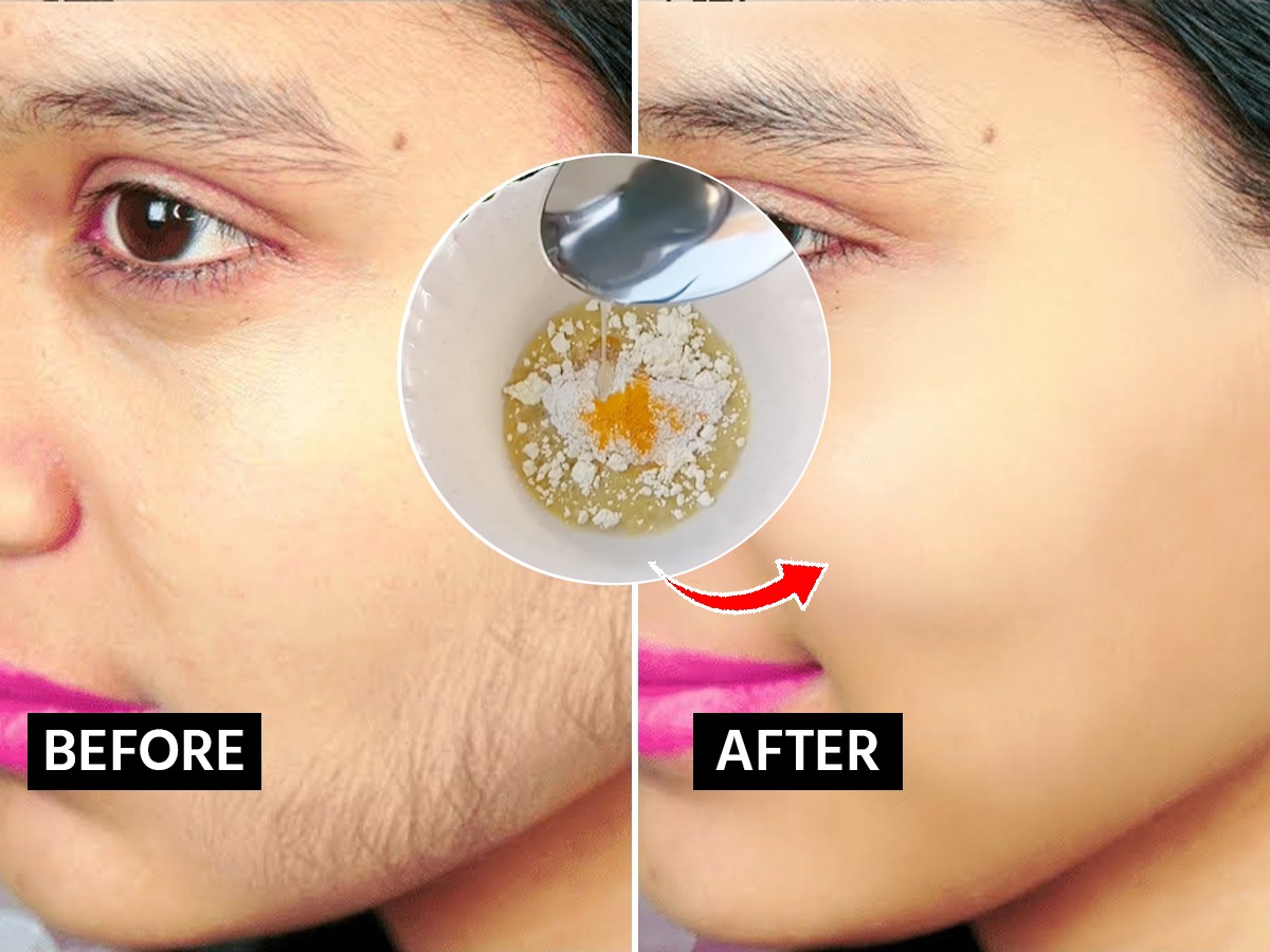 How to Remove Facial Hairs ना थ्रेडींग, ना पेनफूल वॅक्स; चेहऱ्यावरचे