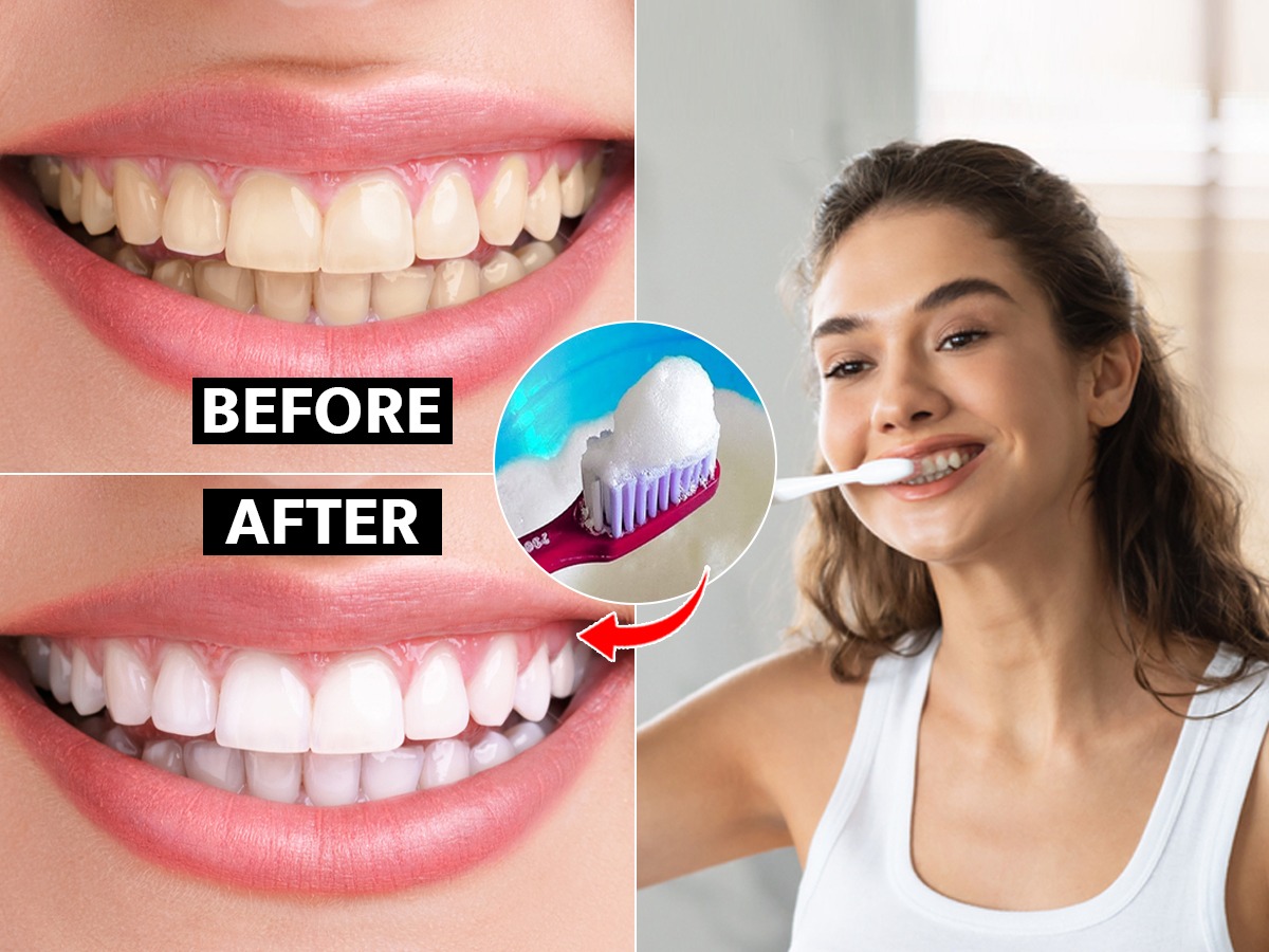 स्वच्छ घासूनही दात पिवळे दिसतात? पांढऱ्याशुभ्र दातांसाठी टुथपेस्टमध्ये