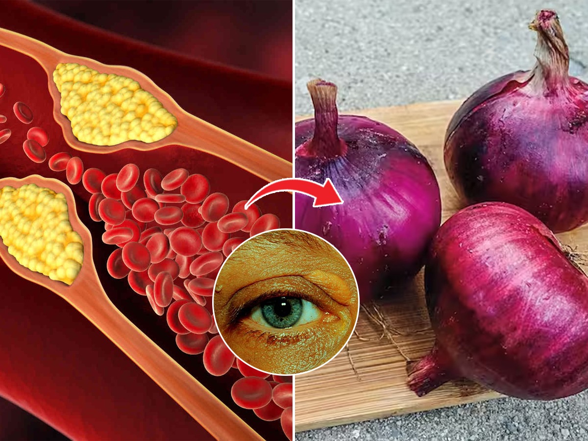 कांदा खाल्ल्याने कोलेस्टेरॉलची पातळी नियंत्रणात येते का? संशोधन सांगते