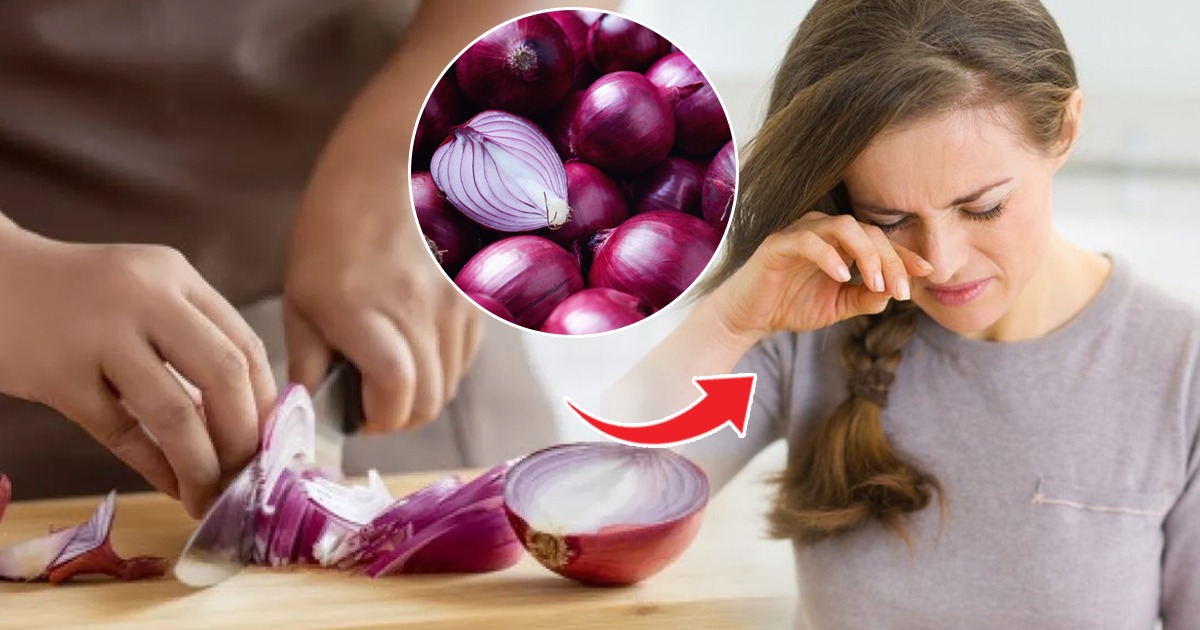 कांदा चिरताना डोळ्यातून पाणी येतं? ५ ट्रिक्स, डोळ्याची आग न होता कांदे