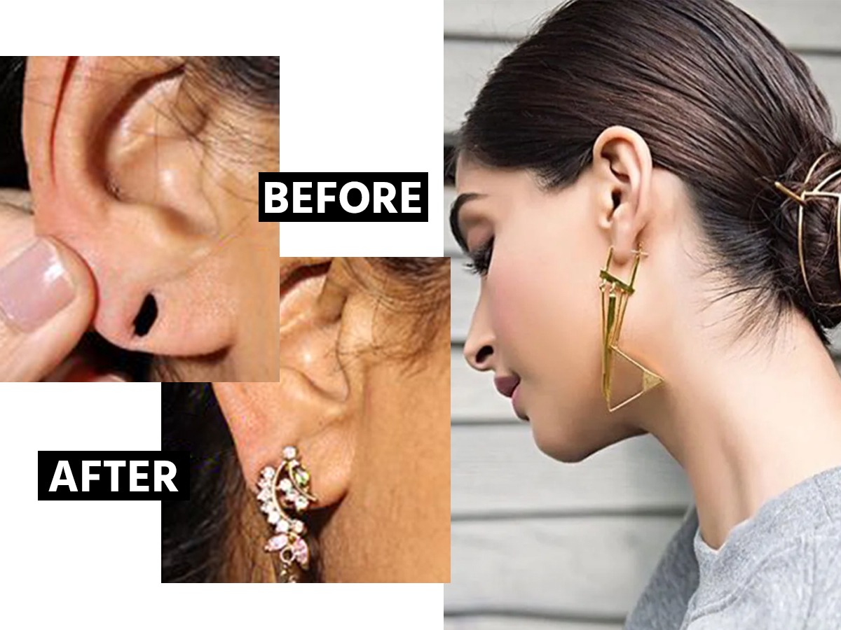 कानाचे छिद्र मोठे झाले, कान ओघळलेत? १ उपाय कानातले लोंबणार नाहीत