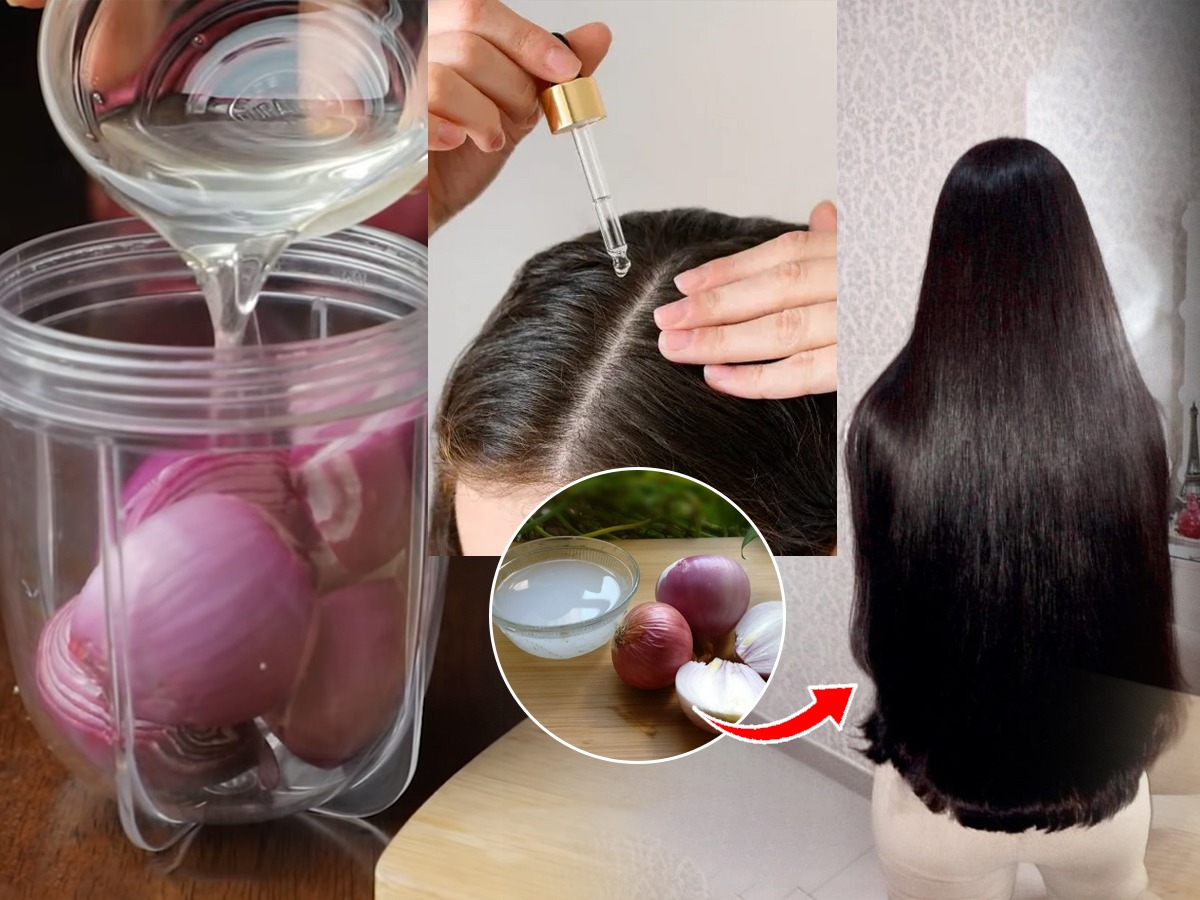 गुडघ्यापर्यंत लांबचलांब वाढतील केस; १ कांदा वापरून लावा खास हेअर सिरम