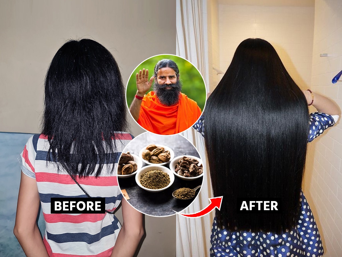 केस गळून विरळ झाले? रामदेव बाबा सांगतात 1 सोपा उपाय, केस होतील लांब