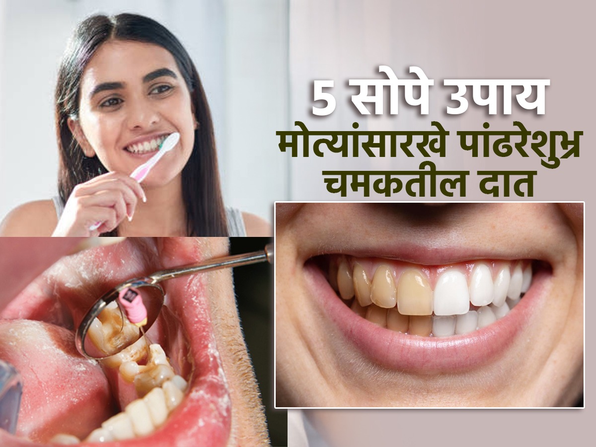 रोज स्वच्छ घासूनही दात पिवळेच दिसतात? ५ सोपे उपाय, दात दिसतील