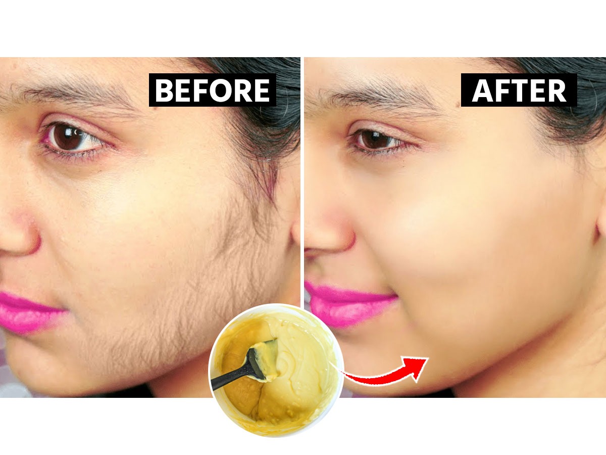 चेहऱ्यावर खूप केस आहेत ? १ चमचा कॉर्नफ्लॉवरहळदपाणी फक्त ३ गोष्टी