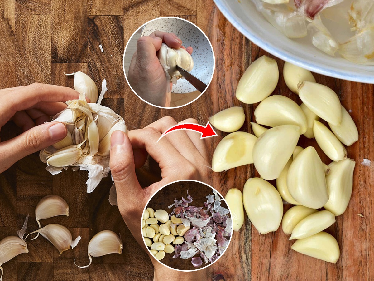 २ मिनिटांत सोलून होईल ढिगभर लसूण; झटपट लसूण सोलण्याच्या ४ ट्रिक्स; वेळ