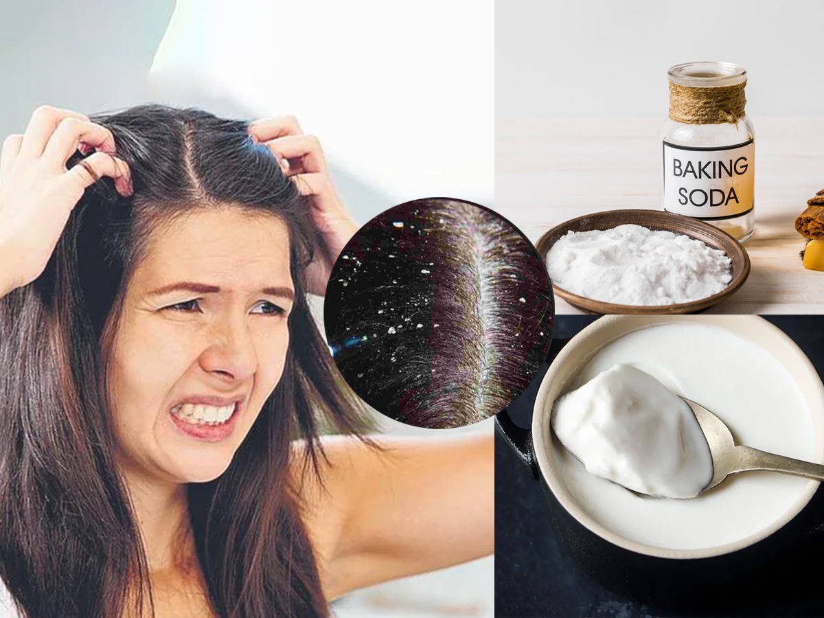 डोक्यात सारखी खाज येते केसांमधून दुर्गंधही येतो? २ सोपे उपाय, मात्र
