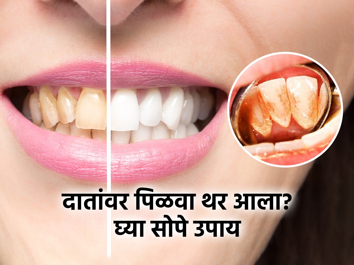 काहीही खाल्लं की दातांवर पिवळा थर येतो? २ मिनिटांत पांढरेशुभ्र दिसतील