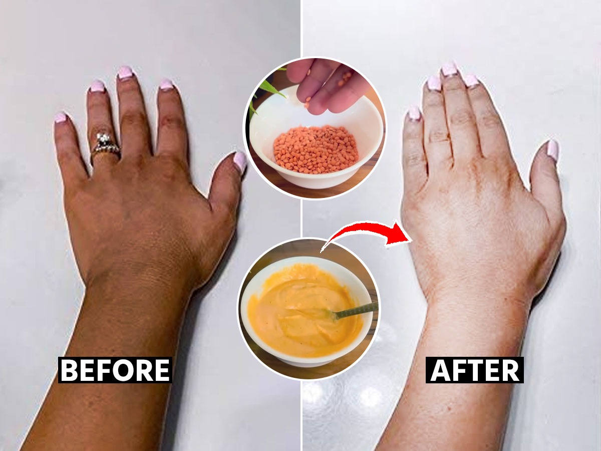 चेहरा चमकदार पण हात पाय खूप काळे पडले? बघा टॅनिंग कमी करण्याचा १ सोपा