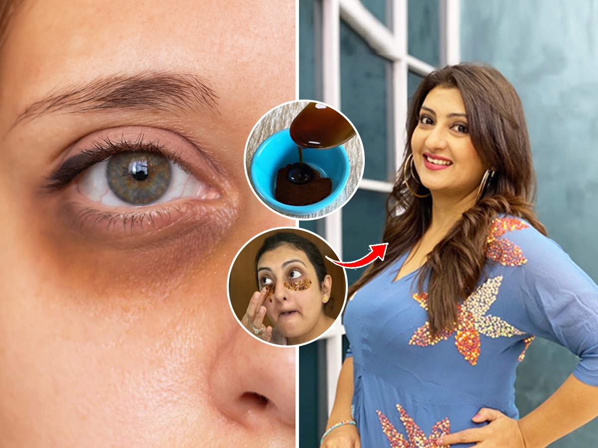 does coffee honey and water get rid of dark circles