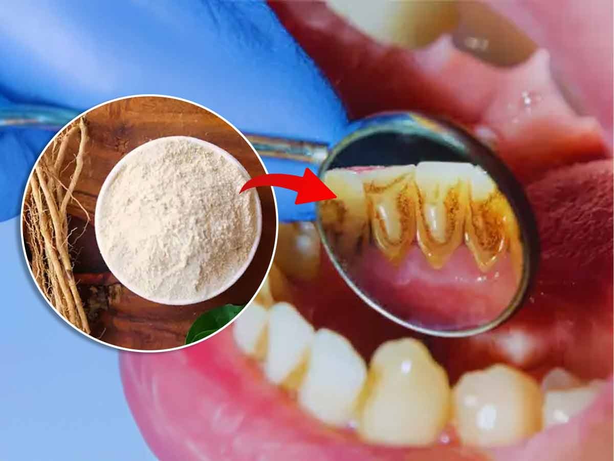 दातांवर चिकटपिवळा थर दिसतो? या खास पद्धतीने घरीच करा दंतमंजन, दात