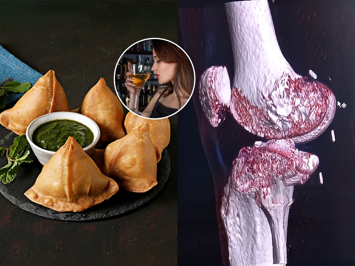 हाडांतील कॅल्शियम शोषतात हे '६' पदार्थ, ऐन तारुण्यात हाडं ठणकतील कंबर