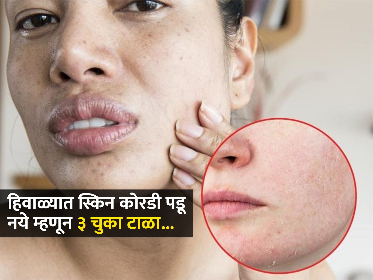 How To Prevent Dry Skin In Winter Naturally