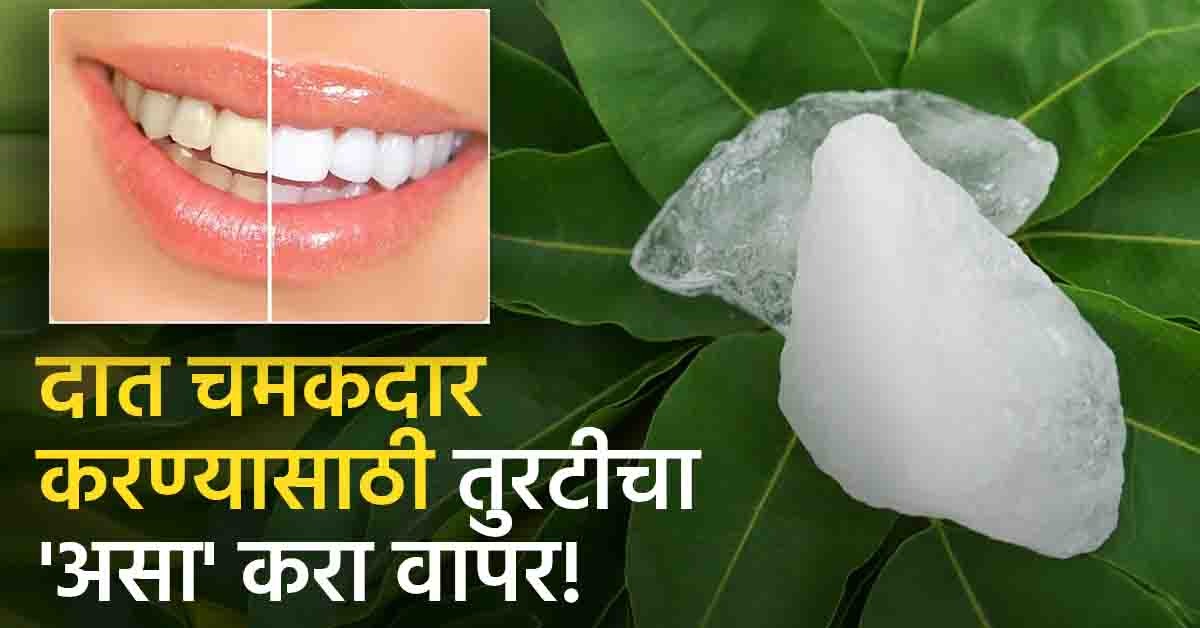 दातांवरील पिवळे दूर करण्यासाठी तुरटीचा 'असा' करा वापर, दात होतील चमकदार