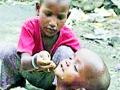 जिल्ह्यात कुपोषणाचे फेरसर्वेक्षण - Marathi News | Malnutrition re-surveyed in the district | Latest chandrapur News at Lokmat.com